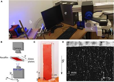 Imaging Erythrocyte Sedimentation in Whole Blood